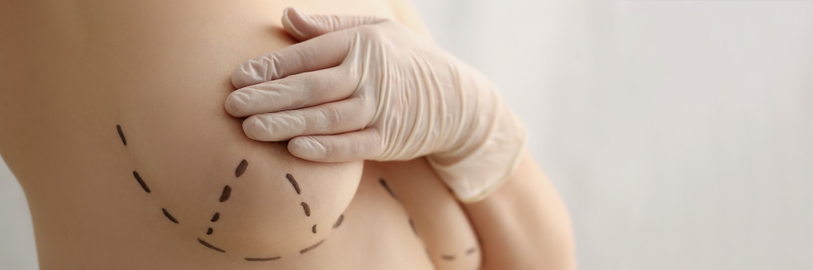 Prețul pachetului de chirurgie plastică în Izmir & Istanbul, Turcia<